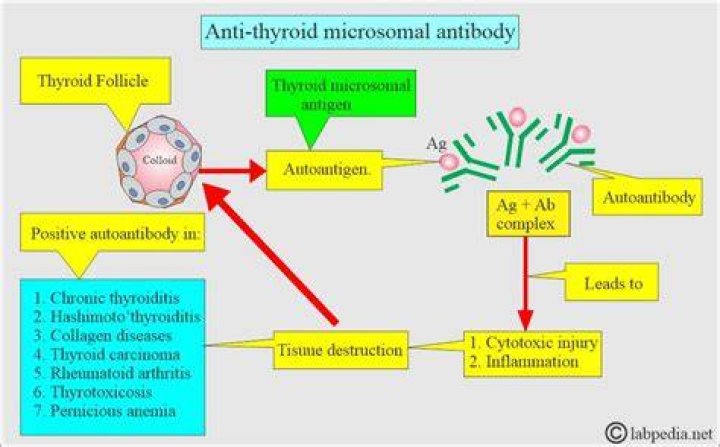 Antithyroid microsomal antibody