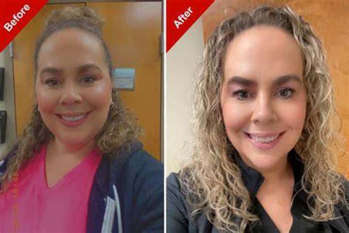 Before and After Pictures Exposed
