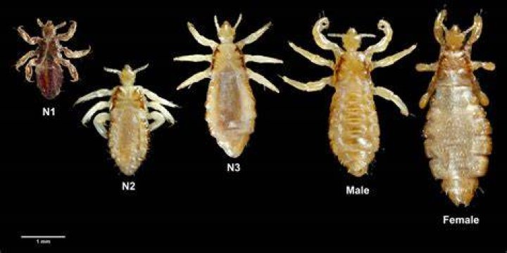 Body lice