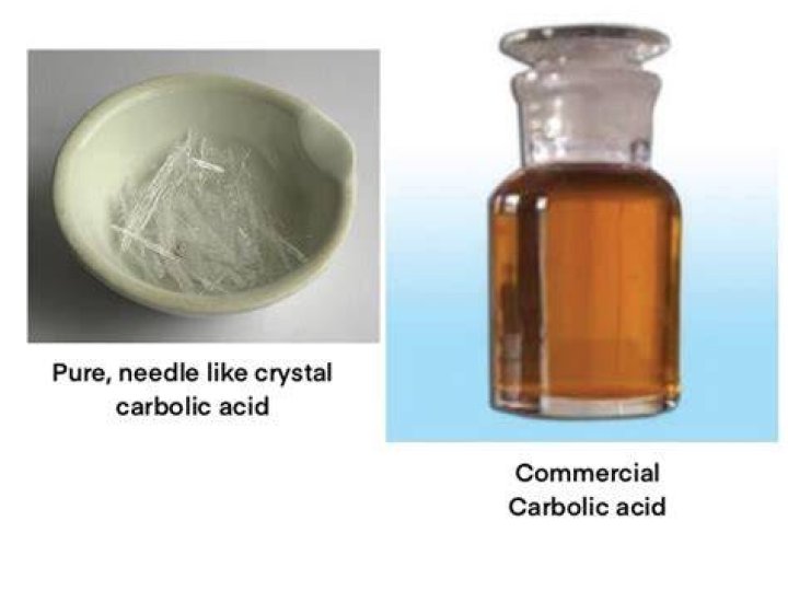 Carbolic acid poisoning