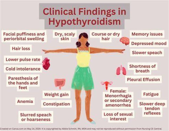 Clinical Features Of Hypothyroidism Mnemonic