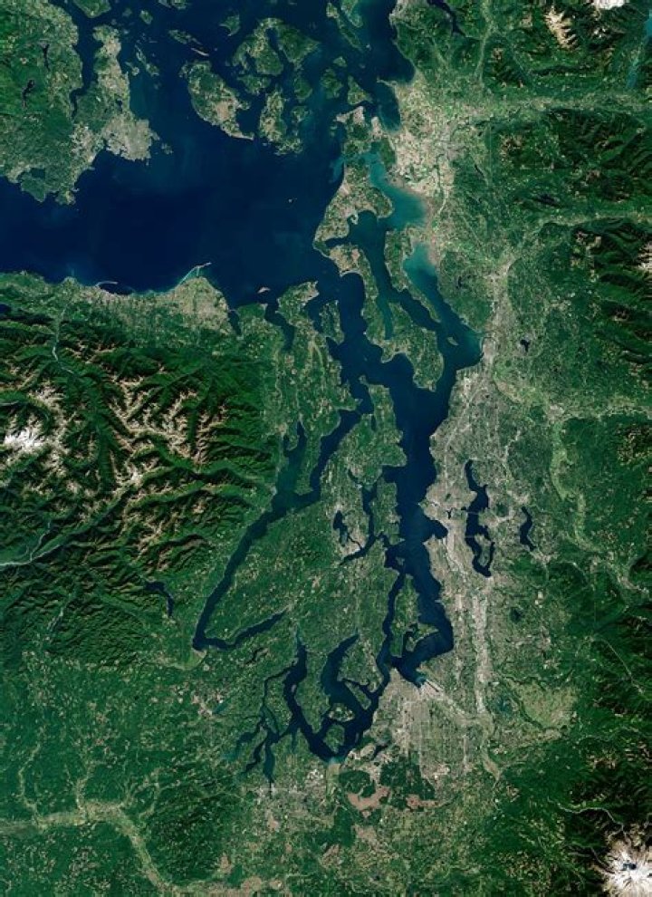 Cosmetic Surgery in Seattle Washington - Puget Sound