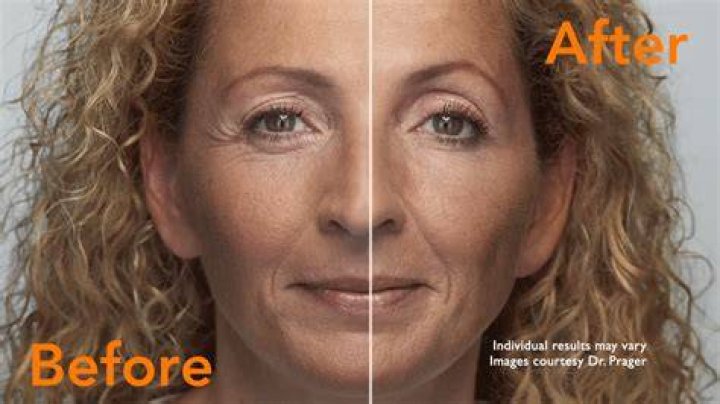 Discover Dr. Butcher Brown's Surgical Brilliance: Unveiling Transformative Results