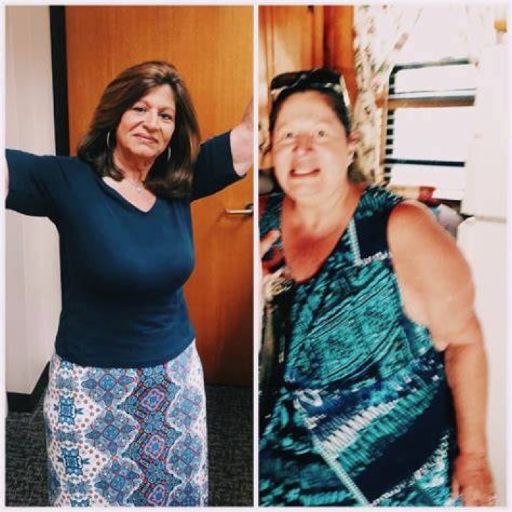 dr moein weight loss surgery