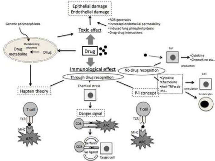 Drug-induced pulmonary disease