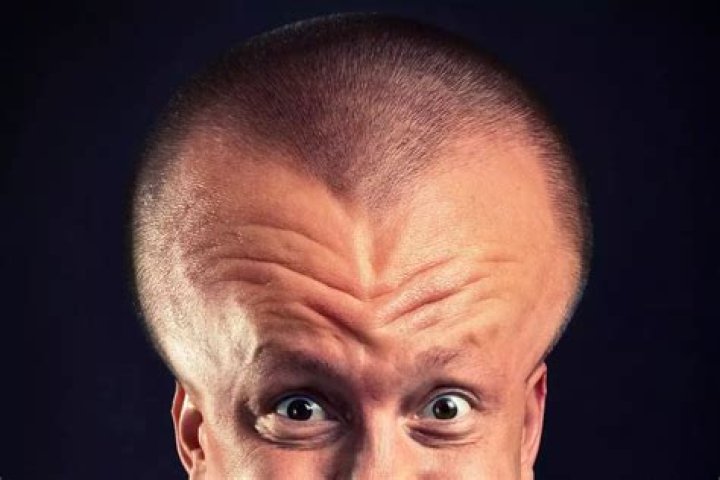 Embracing The Big 4head: A Journey To Self-Acceptance
