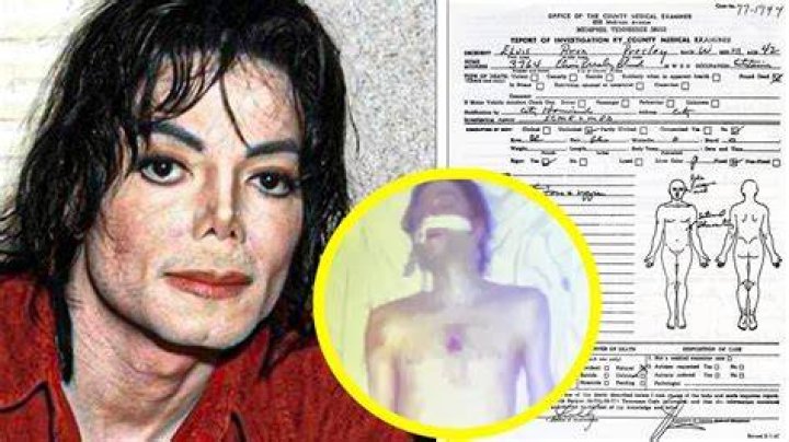 Expert Findings: Michael Jackson Autopsy Results Uncovered