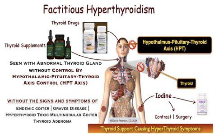 Factitious hyperthyroidism
