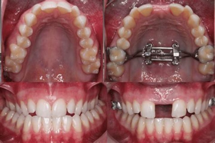 Greeley CO Orthodontics Near Me