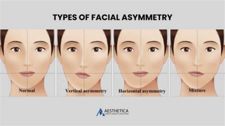 How to Get Rid of an Asymmetrical Face: Simple Steps for a Balanced Look Today