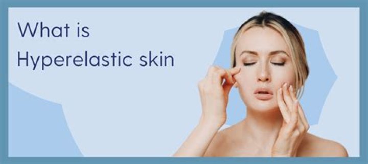Hyperelastic skin