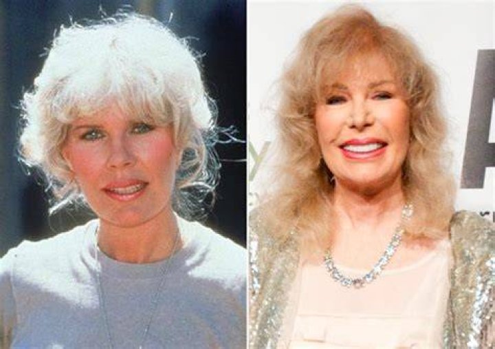 Is Loretta Swit Still Alive?