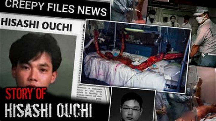 Is The Hisashi Ouchi Photo Real? Uncovering The Truth Behind A Tragic Image