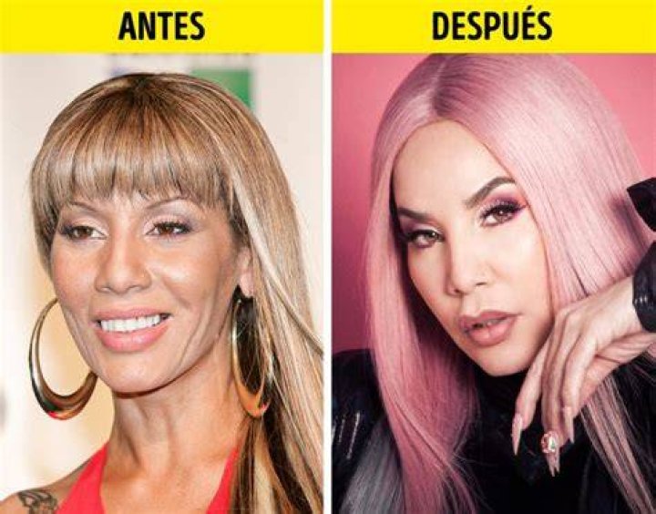 Ivy Queen Before And After