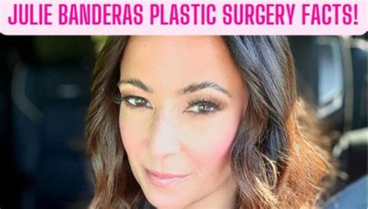 Julie Banderas Plastic Surgery: Unpacking the Speculation and Her Health Path