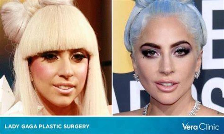 lady gaga surgery hip