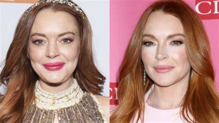 Lindsay Lohan's Plastic Surgery Journey: Uncovering The Truth