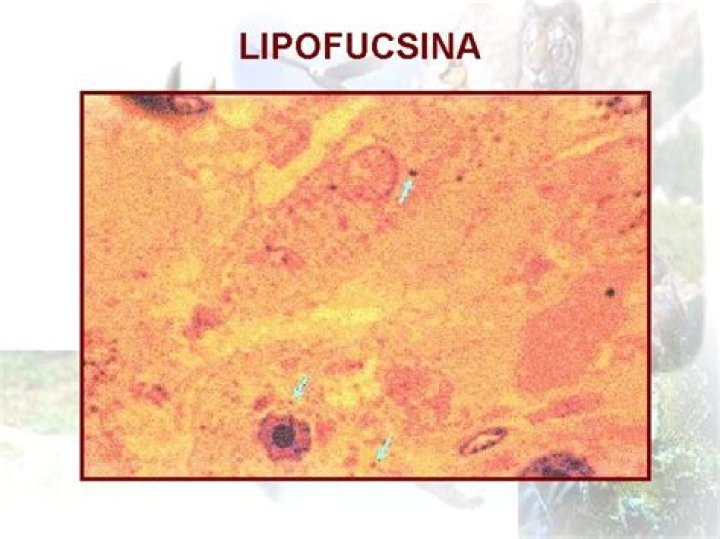 Lipofucsina