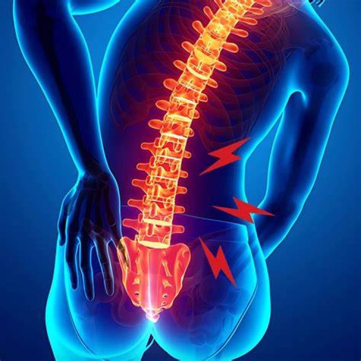 Lower Back Pain Relief Chiropractic Chevron Island QLD