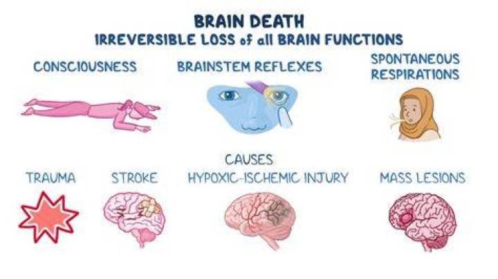 Medical Uses of Brain-Dead Bodies