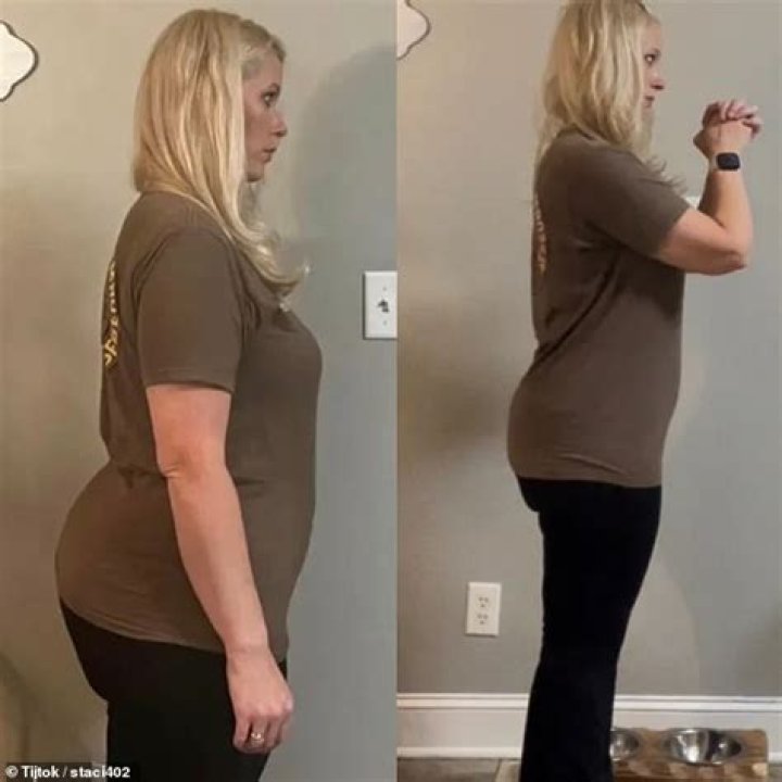Mommy Makeover MS