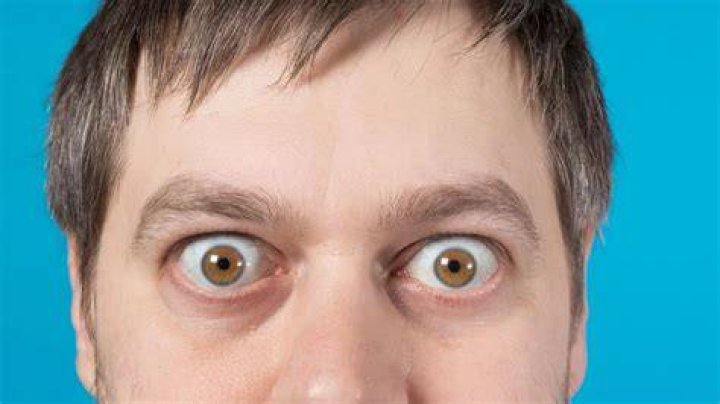 Ojos saltones