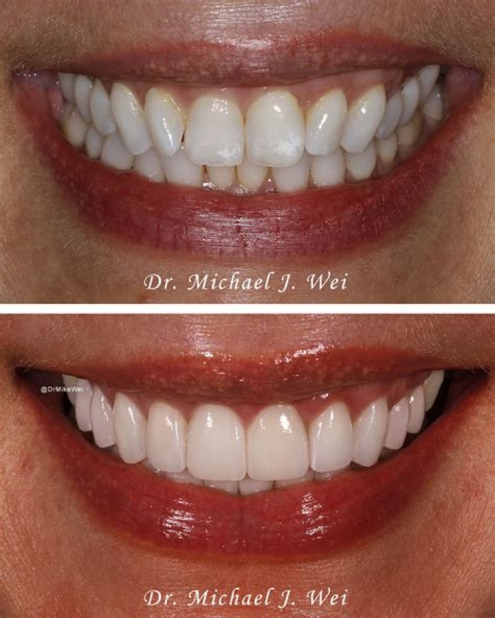 Orthodontist Expert Gold Coast Robina I Amazing Ways to Smile with Style