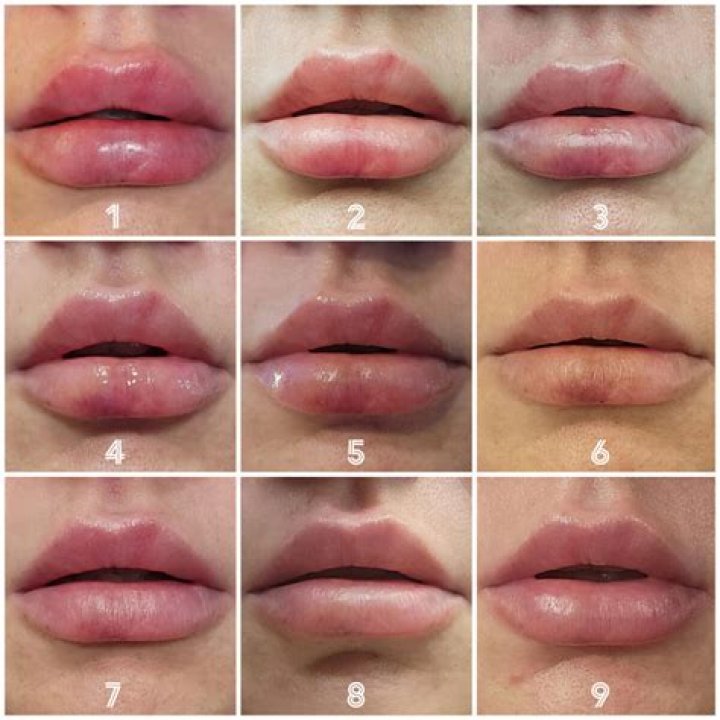 Paris Hilton's Cosmetic Enhancements: A Detailed Guide To Her Fillers