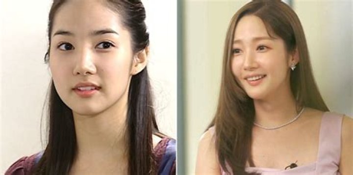 Park Min Young's Candid Journey With Plastic Surgery