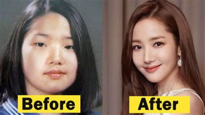 Park Min Young's Journey Before Plastic Surgery