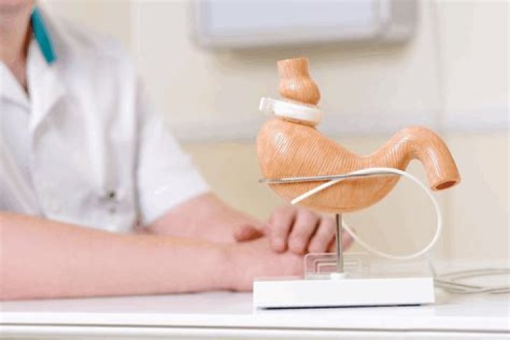 Post Bariatric Surgery Must Haves