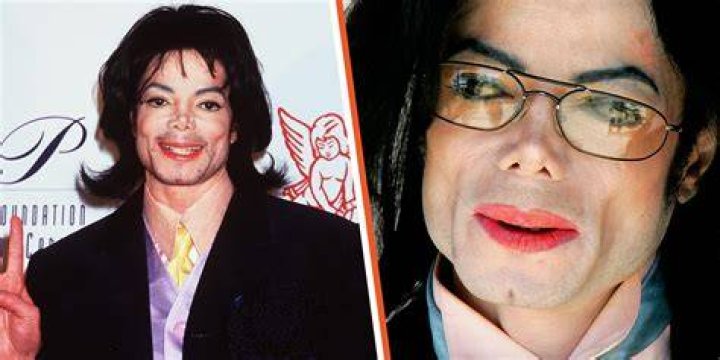 Revelations: Michael Jackson's Autopsy Photo Revealed