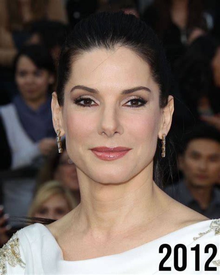 Sandra Bullock's Plastic Surgery Journey Explored