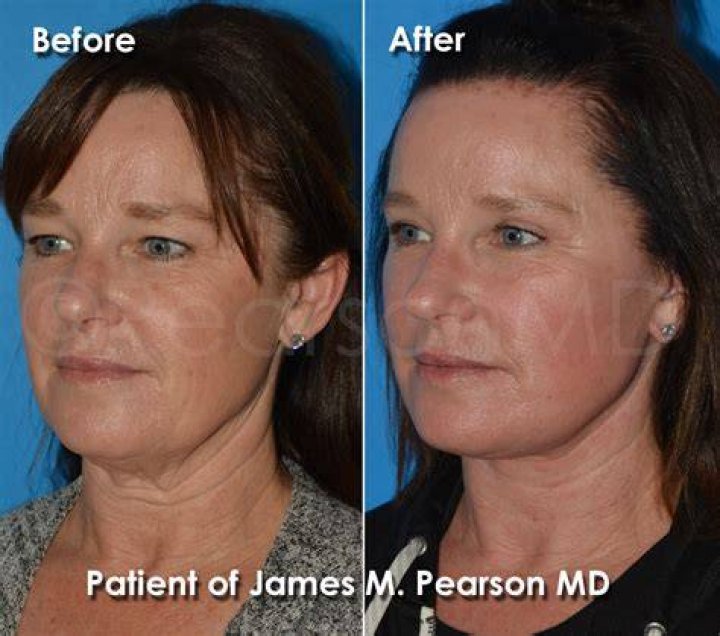 St Clair Shores Michigan Board Certified Plastic Surgeon