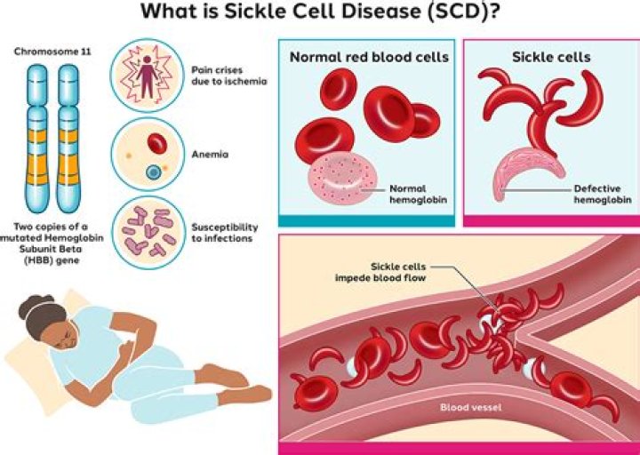 Stepsister Dies After Battle with Sickle Cell Anemia