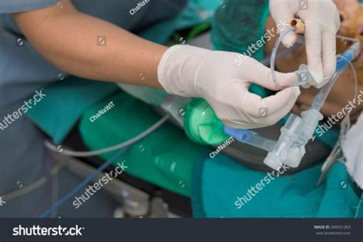 Suctioning: Endotracheal