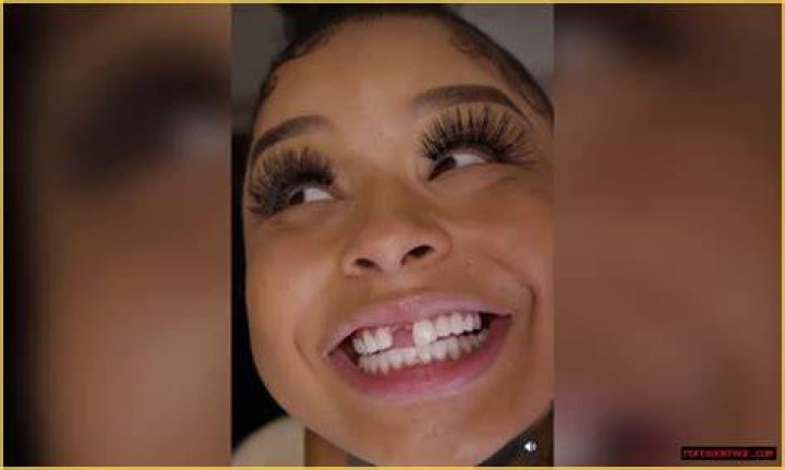 The Truth Behind Chrisean Rock's Lost Tooth