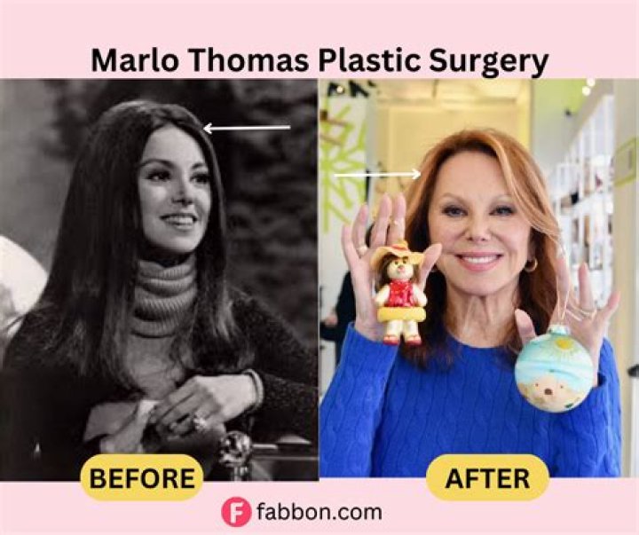 Uncover The Secrets Of Marlo Thomas's Cosmetic Journey: Discoveries & Insights