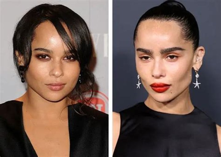 Unlock The Secrets Of Zoe Kravitz Surgery: Discoveries And Insights