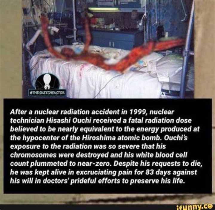 Unraveling The Tragedy Of Hisashi Ouchi: A Story Of Radiation And Resilience
