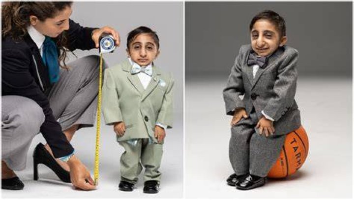 Unveiling The Enigma: Who Is The World's Smallest Person?