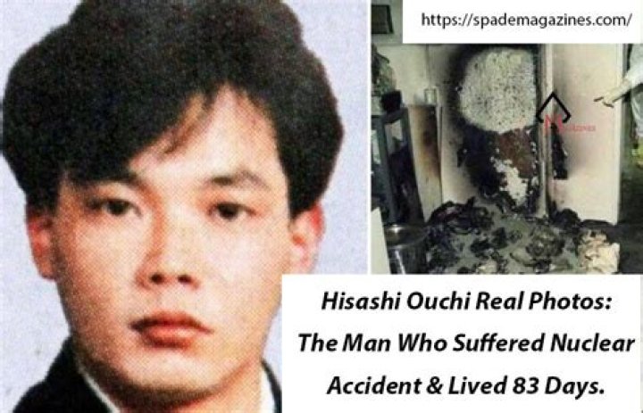 Unveiling The Life And Legacy Of Hisashi Ouchi: A Portrait In Photos