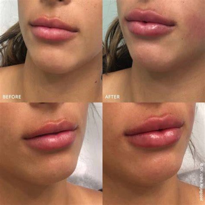 Unveiling The Secrets Of The "Brooke Monkout Makeup Look Lip Filler"