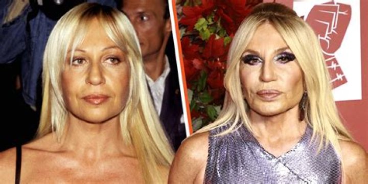Unveiling The Truth Behind Rob Lowe's Plastic Surgery