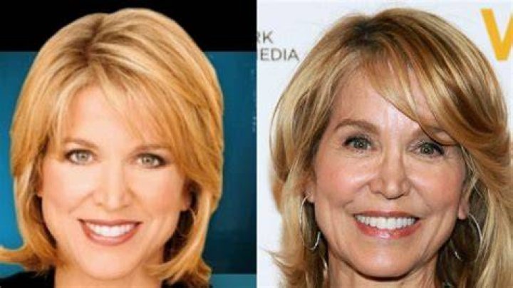 Unveiling The Truth: Paula Zahn And Her Journey With Plastic Surgery