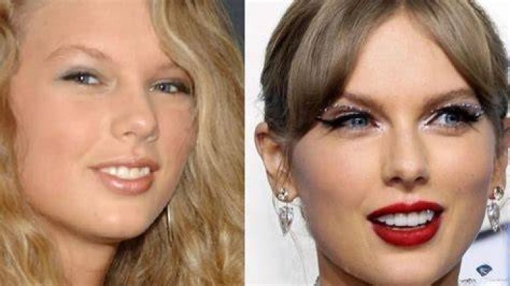 where did taylor swift get her veneers done
