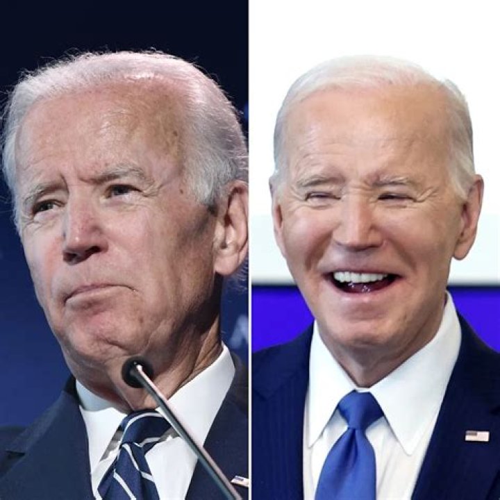 why does joe biden look like he's had plastic surgery